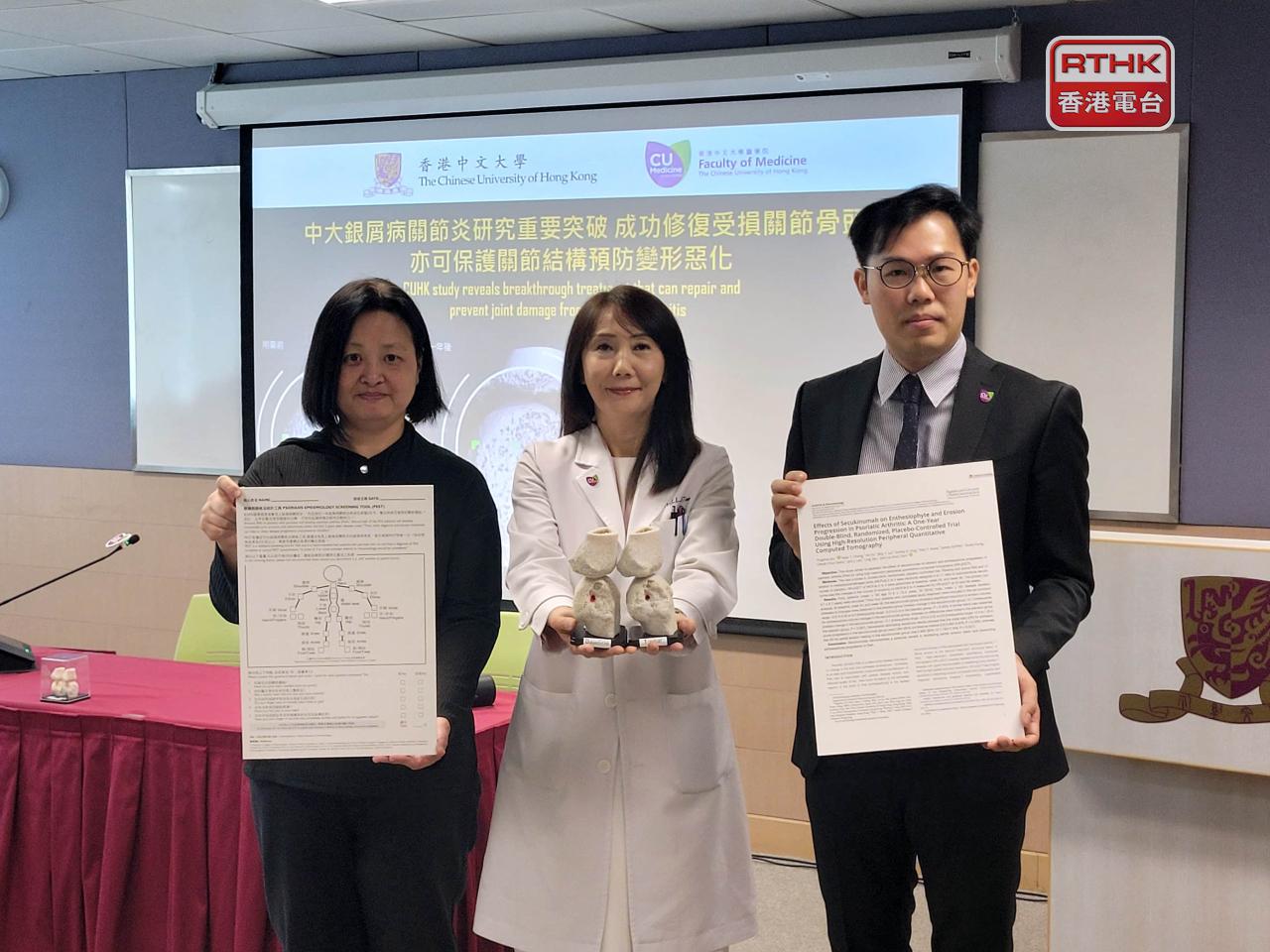 負責研究的學者認為，「白介素-17」抑制劑治療有助修復患者的關節受損，防止骨骼進一步變形，有效治療銀屑病關節炎。（實習記者廖恒傑攝）