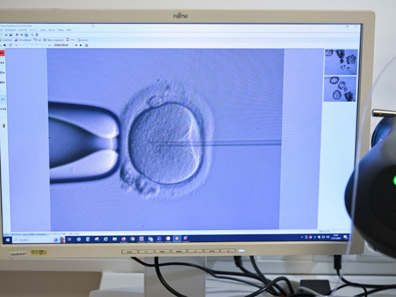 《2025年人類生殖科技（牌照）（修訂）規例》今年12月1日生效。（法新社資料圖片）