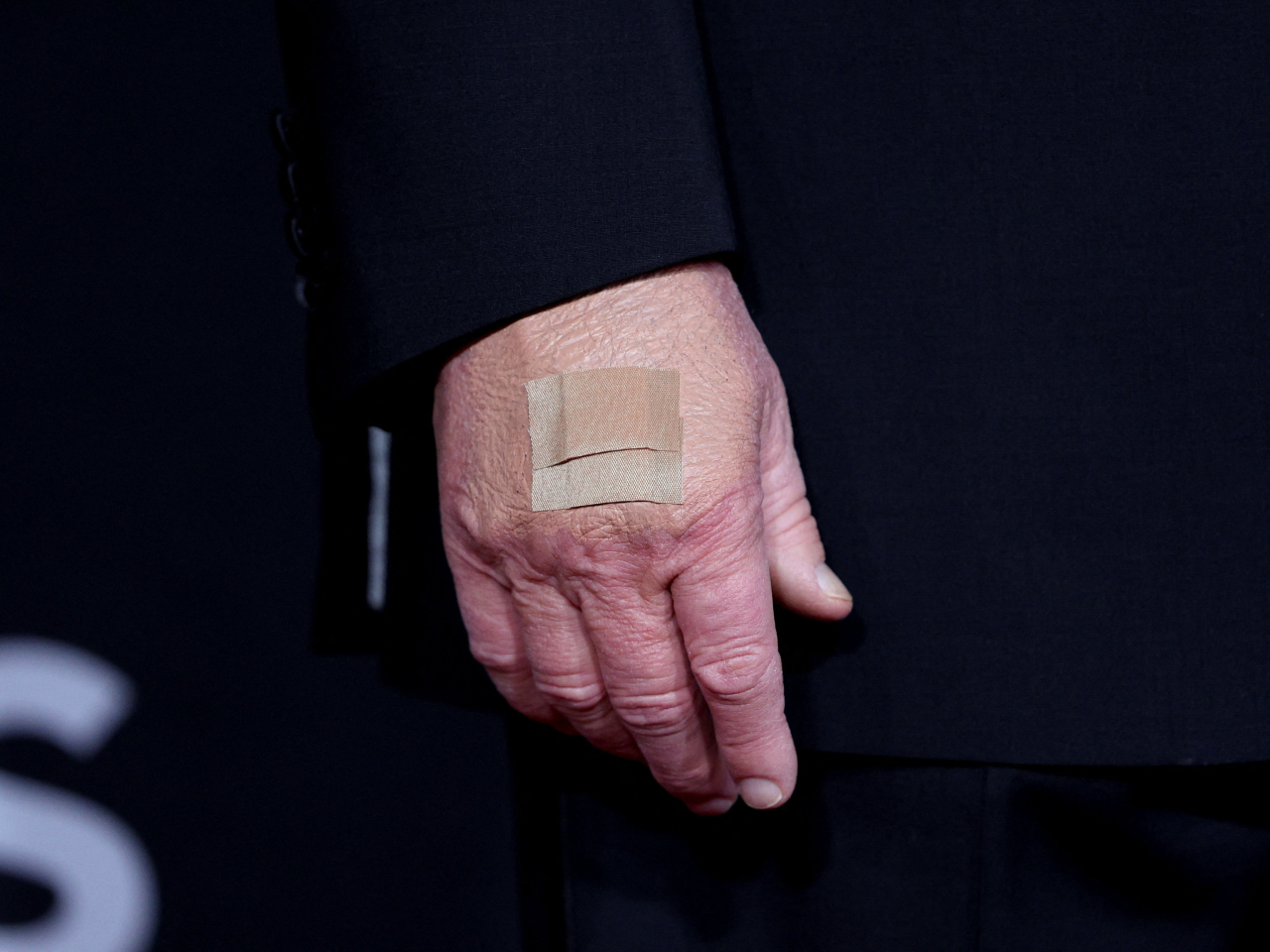 Donald Trump said he applies makeup or bandages to his hand after it is "whacked" &ndash;  for example after Pam Bondi hit the back of his hand with her ring while giving him a high-five. File photo: Reuters