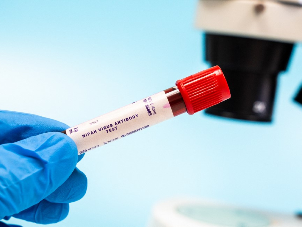 印度東部的西孟加拉邦近期出現尼帕病毒疫情。（法新社資料圖片）