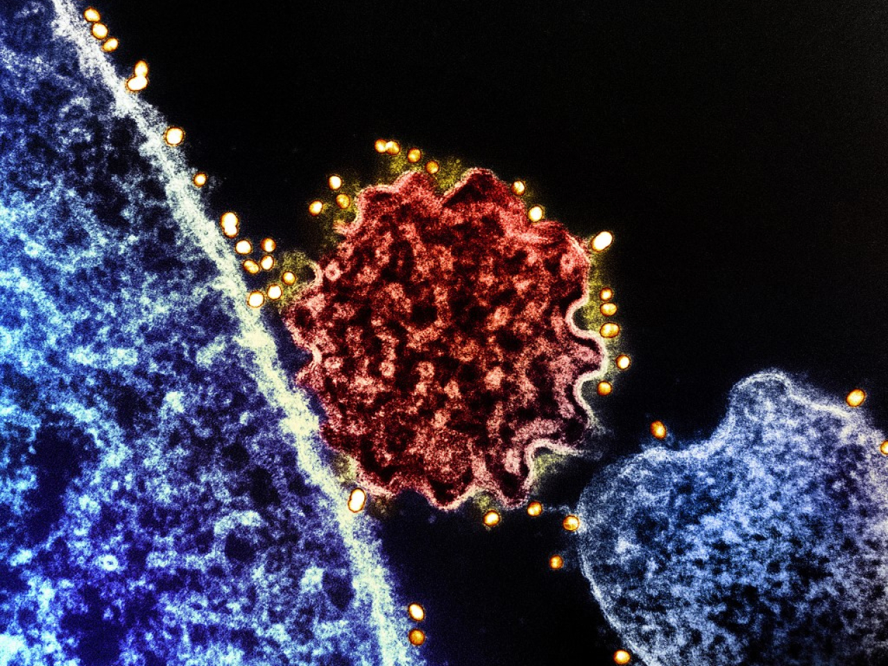 港大教授杜啟泓表示，感染尼帕病毒可出現腦炎及呼吸困難等併發症，病死率高達40%至75%。（法新社）