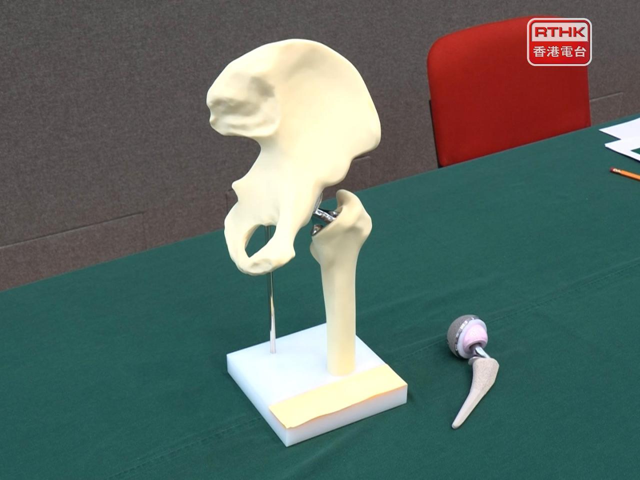 港大醫學院表示，機械臂能夠根據術前規劃，控制髖臼杯的放置方向及植入深度，角度精度可達2度以內，深度誤差可控制在2毫米以內。（鍾家銘攝）