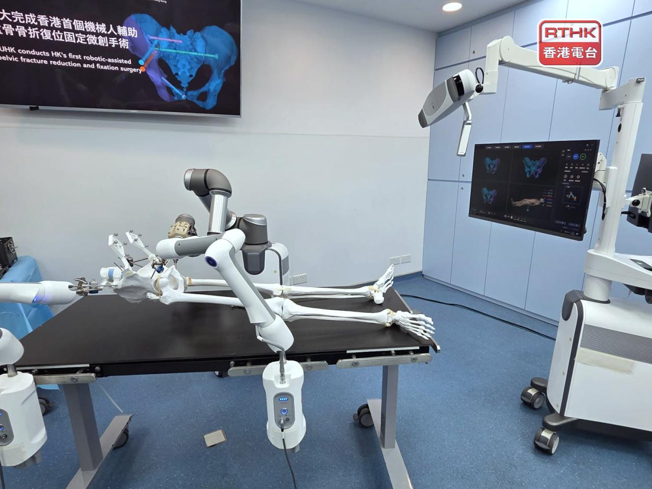 中文大學醫學院首次利用創新骨科機械人手術系統，成功進行香港首例機械人輔助盆骨骨折復位固定微創手術。（陳曉慶攝）