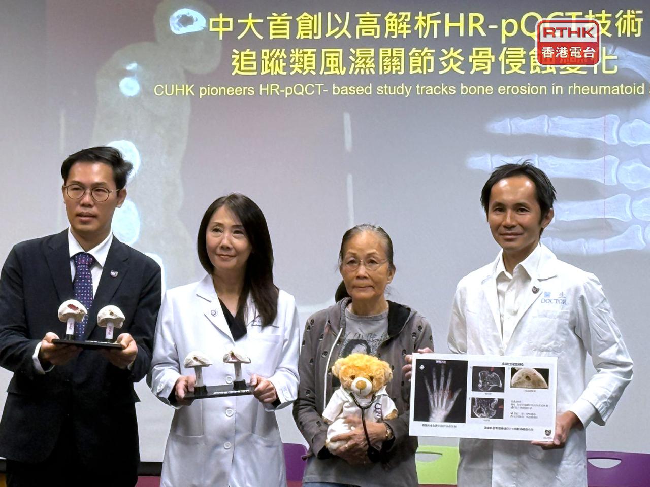 團隊計劃將 HR-pQCT納入類風濕關節炎早期評估研究，發展以影像學為基礎的風險分層模型。（任浩鋒攝）